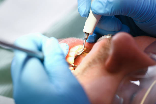 Best Emergency Treatment for Oral Infections in Kenai, AK